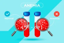এনিমিয়া: একটি উপেক্ষিত স্বাস্থ্য সমস্যা